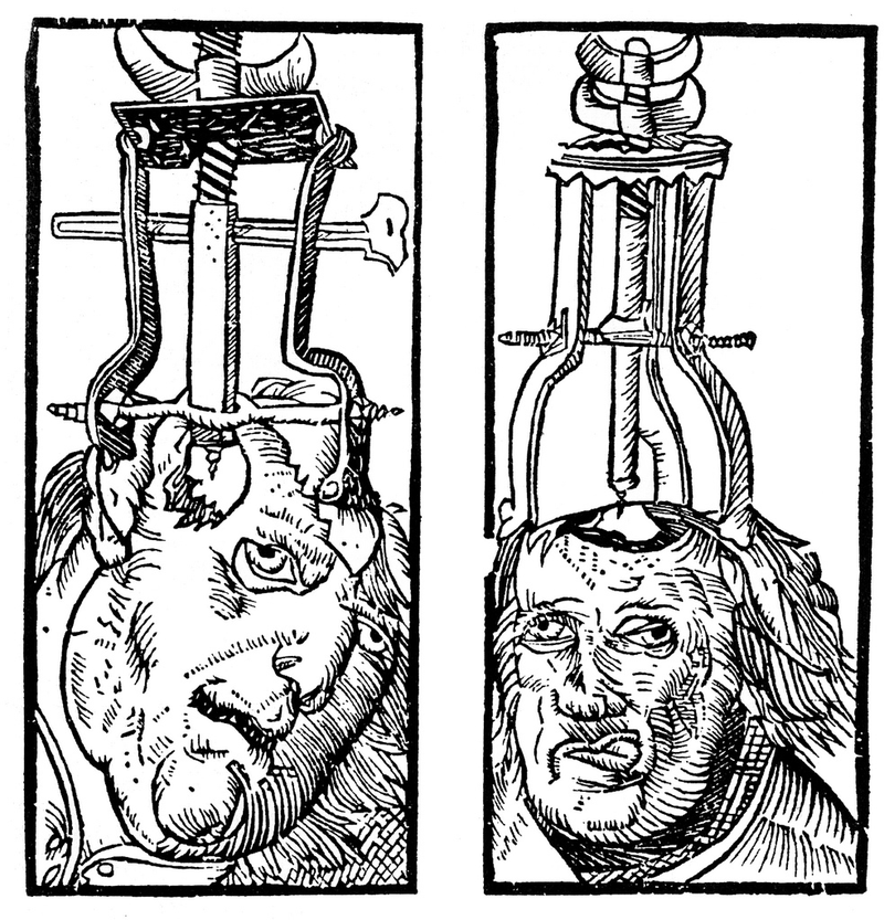 Illustration for article titled Why would you want someone to drill a hole in your skull?